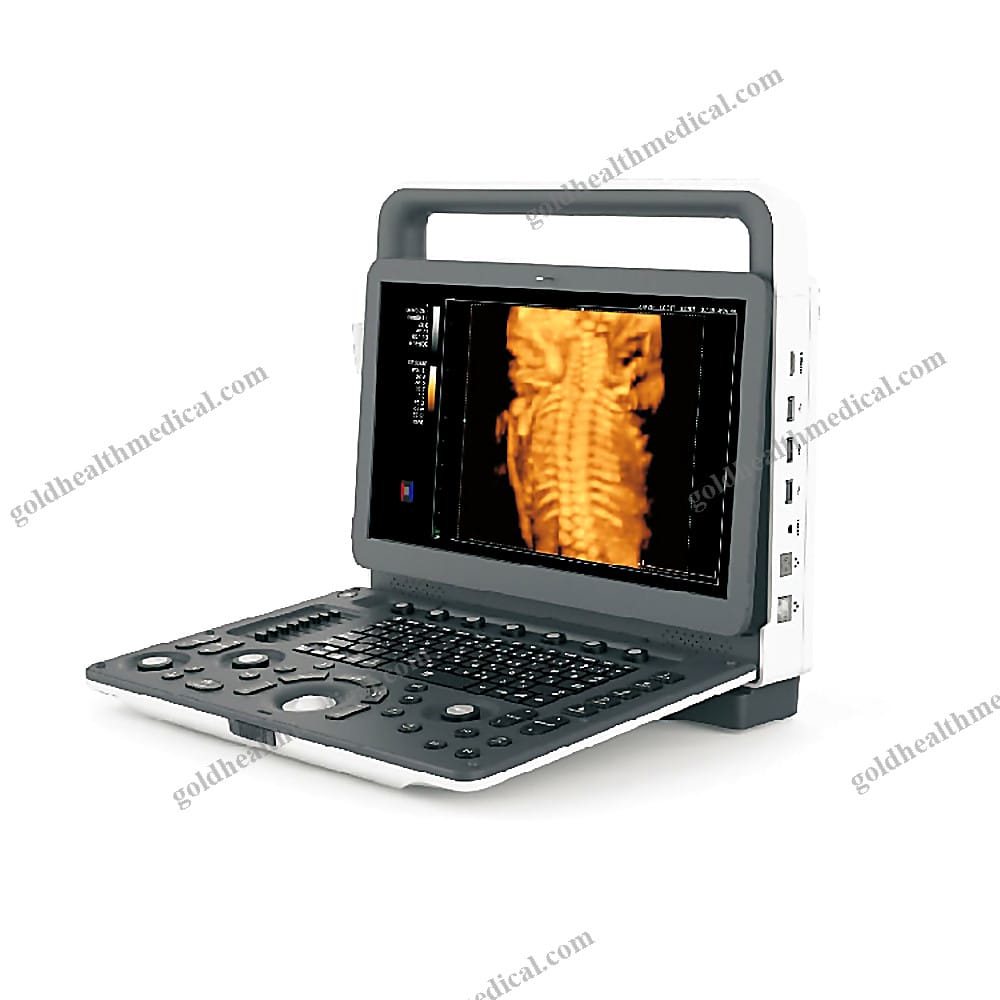 Portable Color Doppler Ultrasound System