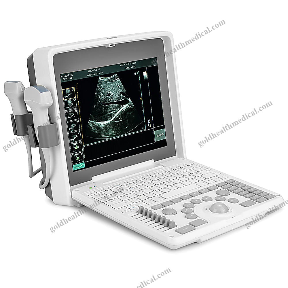 Portable Color Doppler Ultrasound Machine With Trolley