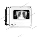 Portable Handheld XRay Machine for Chest Diagnosis