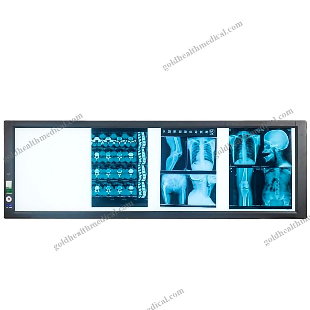 MT Medical Ultra Thin Four Panel XRay Film Viewer Negatoscope Scanner Box