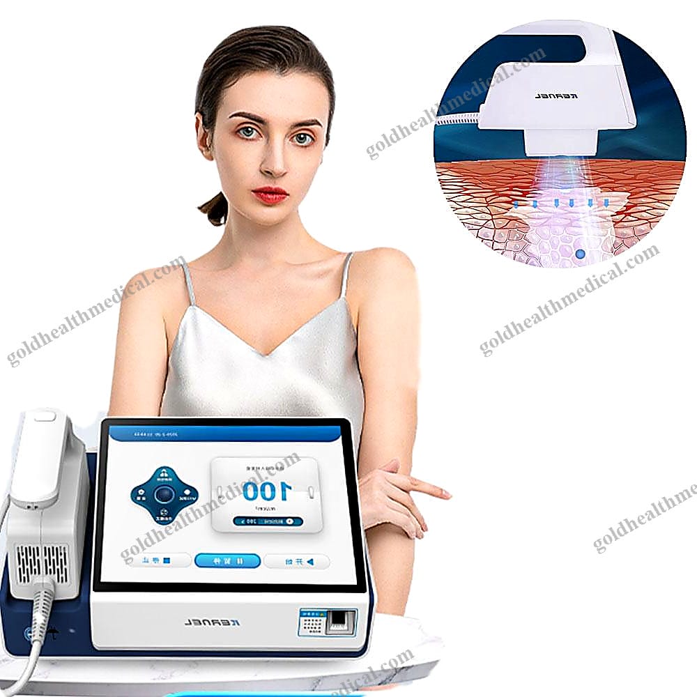 Excimer Laser 308nm UVB Lamp CN30