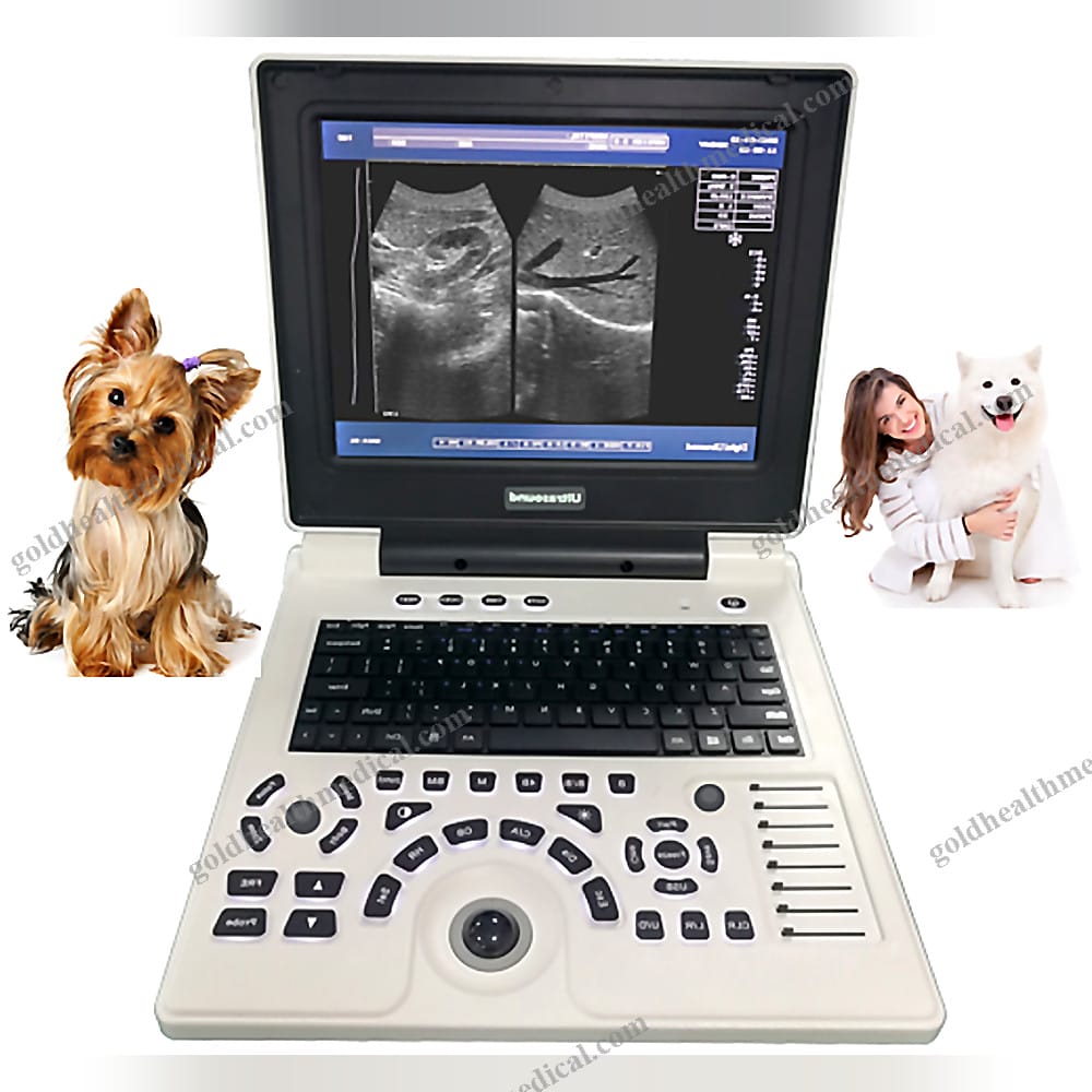 Portable HD Ultrasound Machine With Optional Probes
