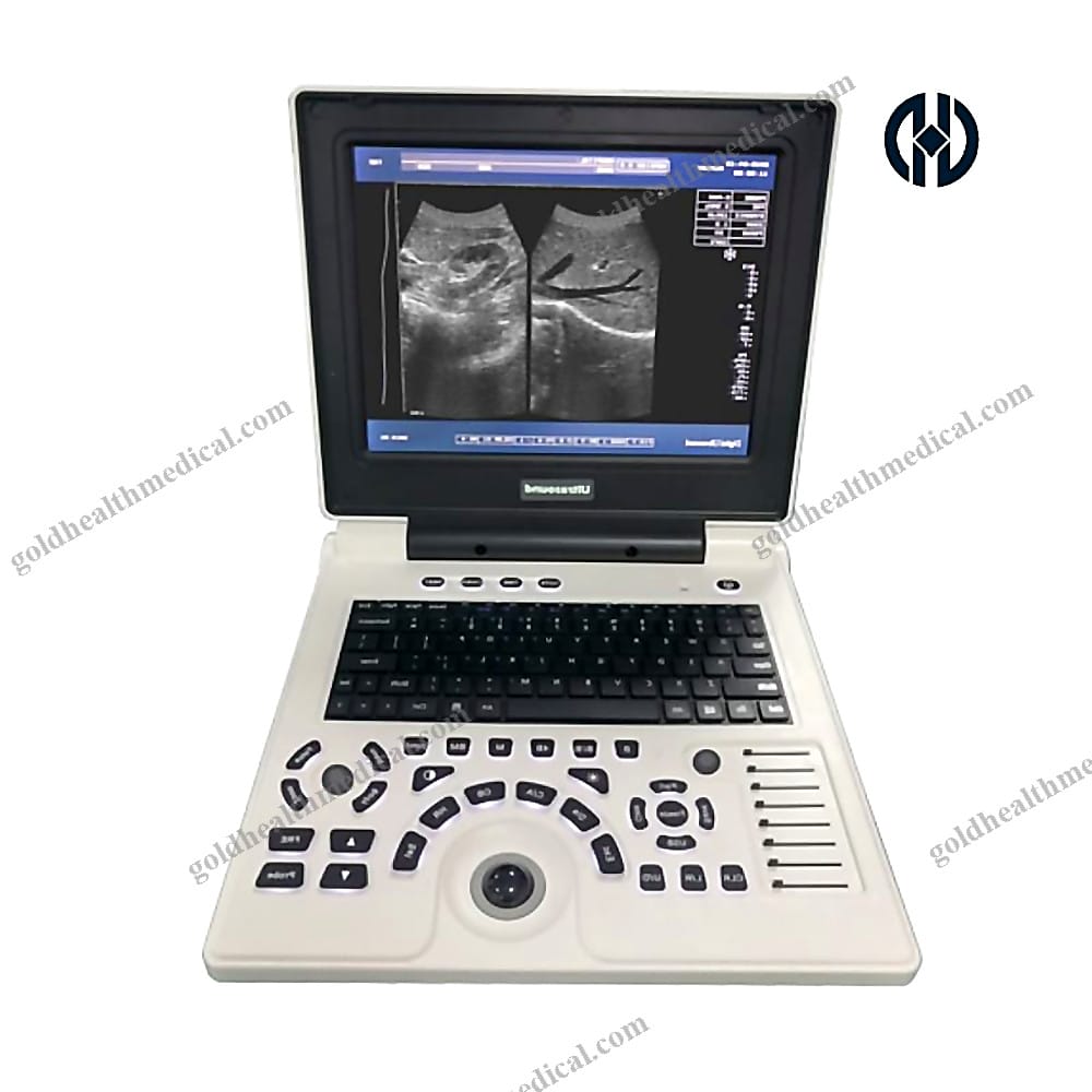 Portable HD Ultrasound Machine With Probe