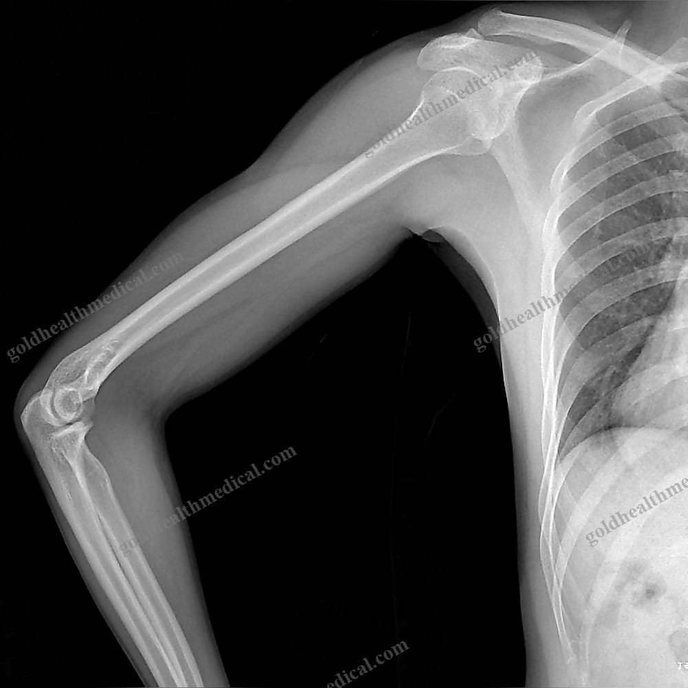 Trixell DR XRay Panel for Orthopaedic Clinics Mobile