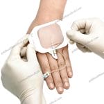 IV Cannula Fixation Dressing with Transparent Film for HospitalClinic
