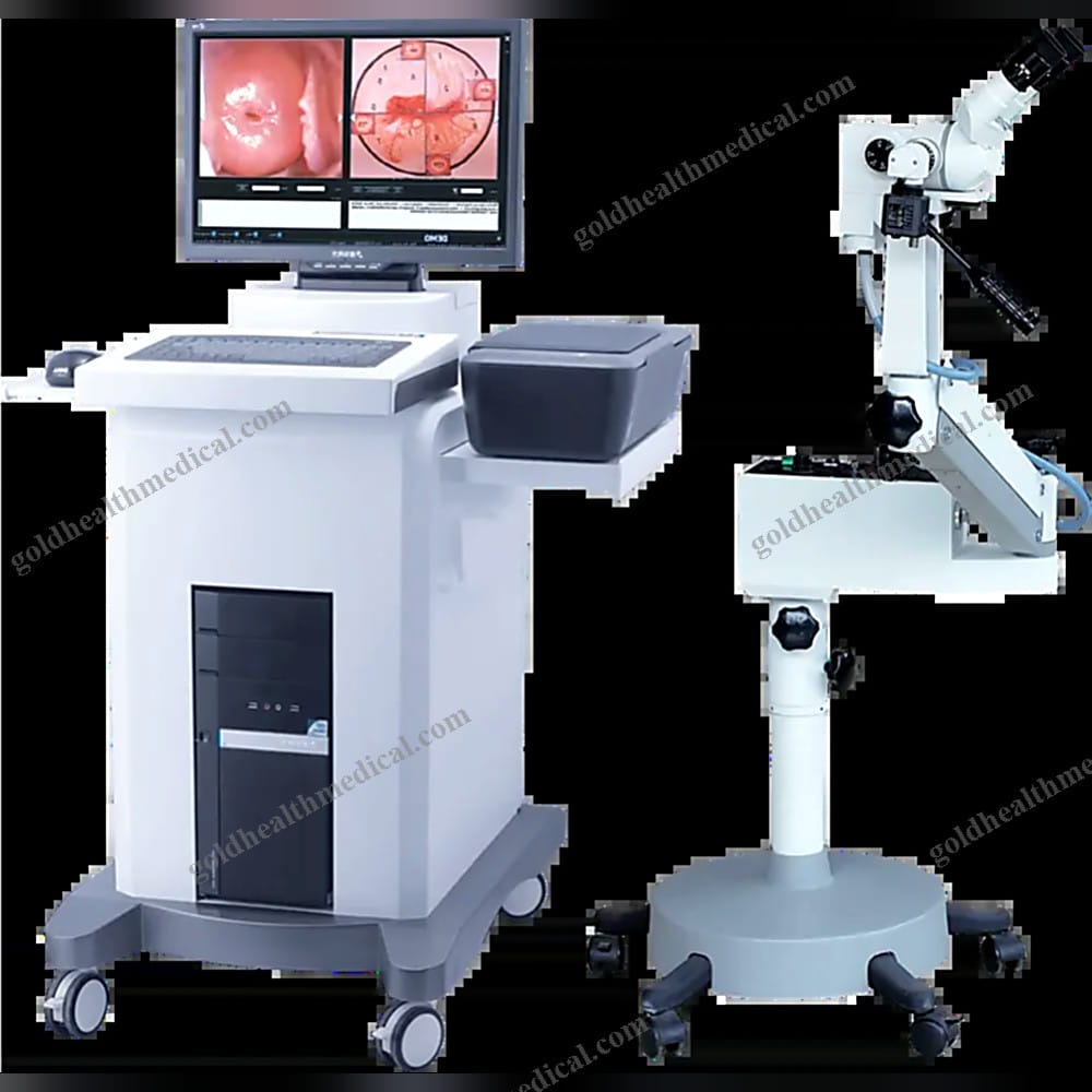 Optical Video Colposcope For Sale