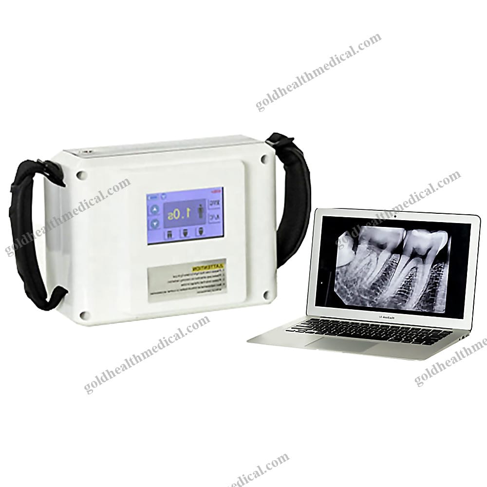 Portable XRay Dental Equipment