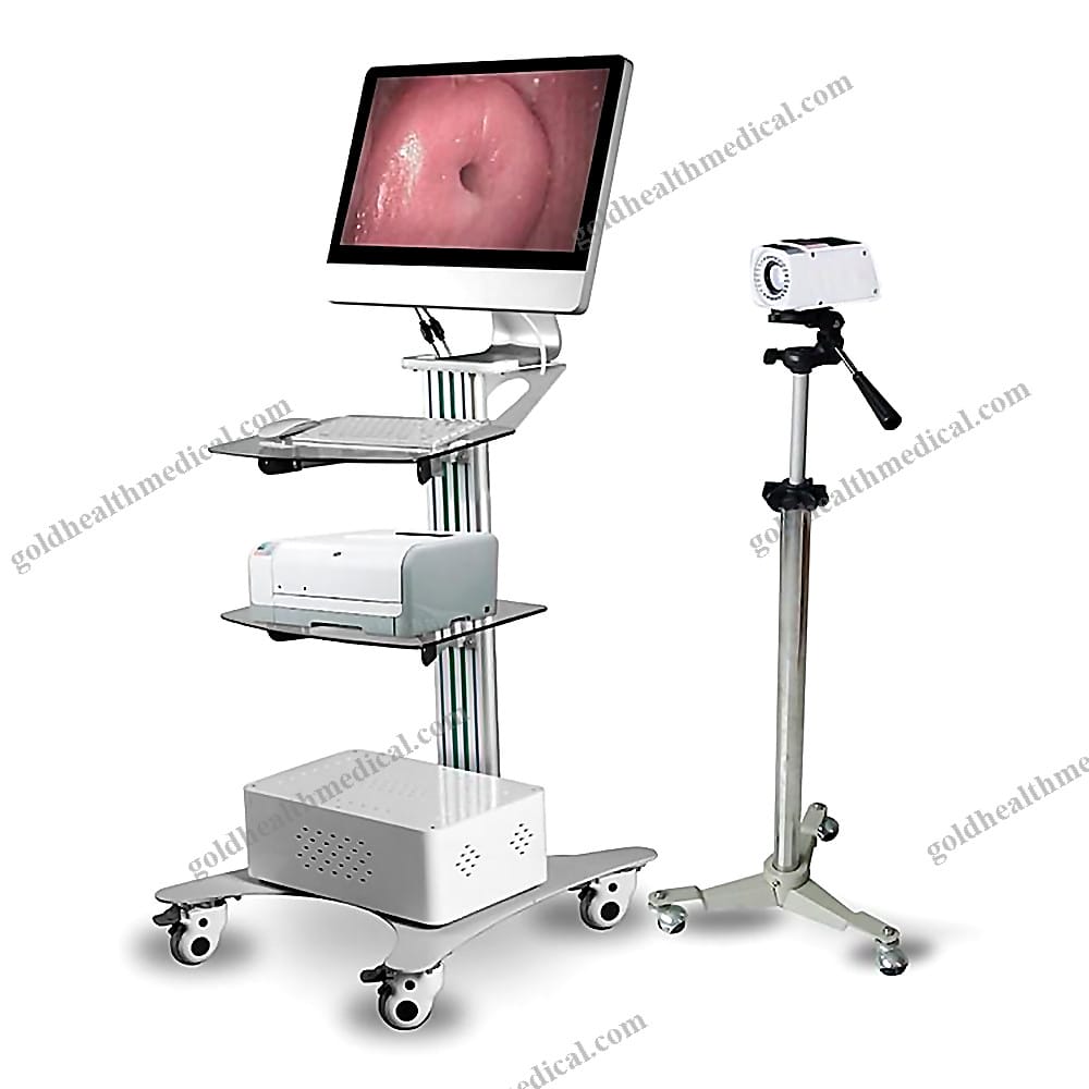 Gynecology HD Digital Colposcope Endoscopy System