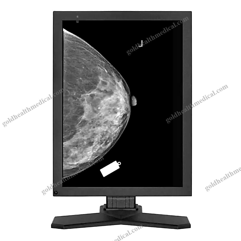 5MP Diagnostic Medical Display MD52G
