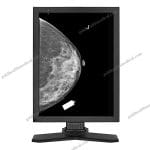 5MP Diagnostic Medical Display MD52G