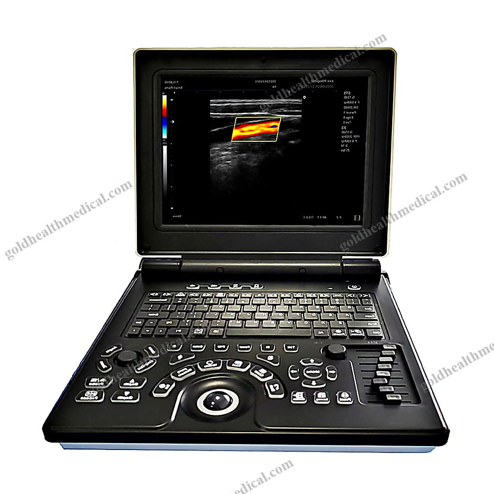 MNE20 Color Doppler Ultrasound System
