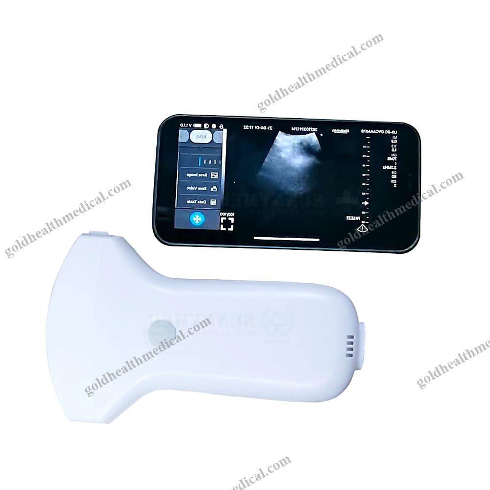 SYA052C Portable Wireless Ultrasound Scanner