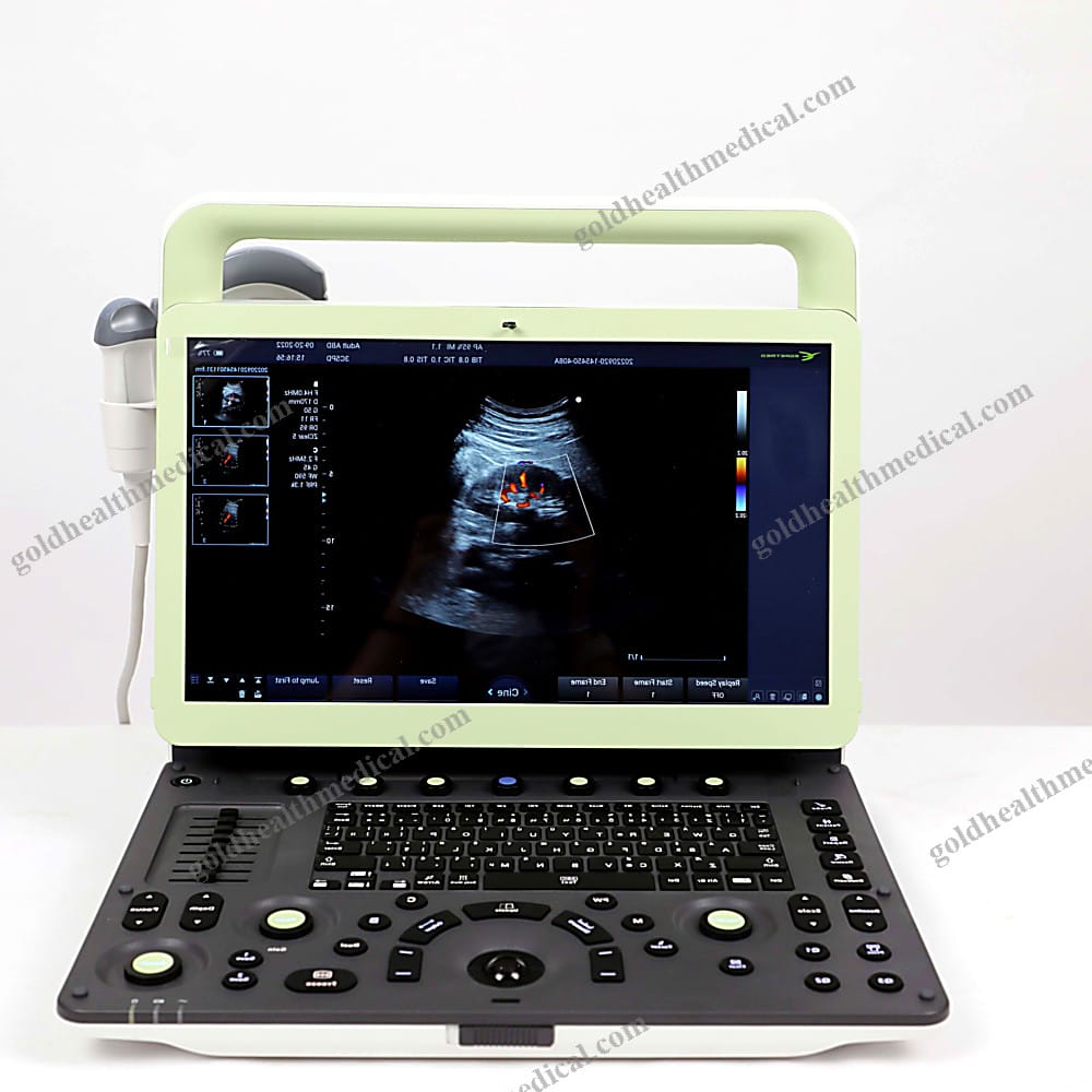 AMCU78 3D4D Color Doppler Ultrasound