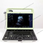 AMCU78 3D4D Color Doppler Ultrasound
