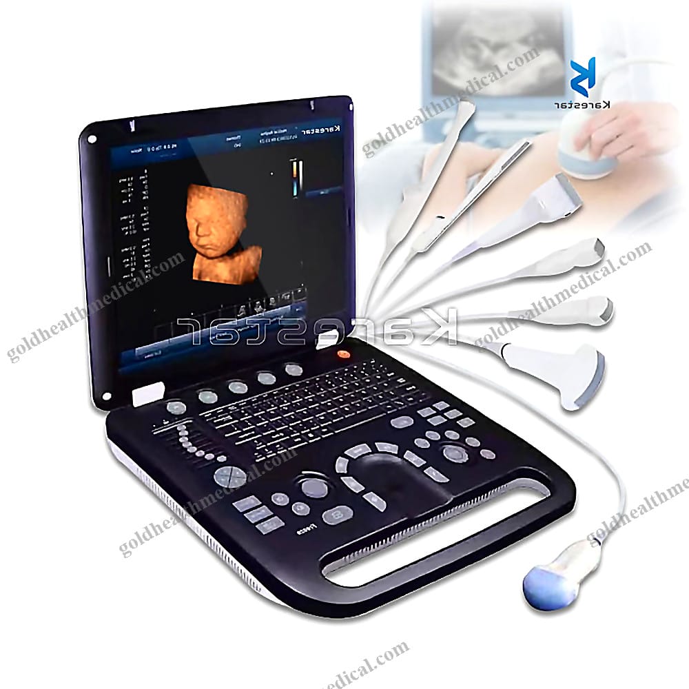Affordable Portable Color Doppler Cardiac Ultrasound Scanner