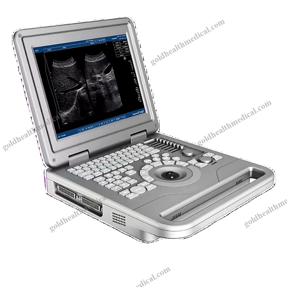 Chenwei Portable Ultrasound Scanner HighPerformance Medical Instrument Laptop Ultrass