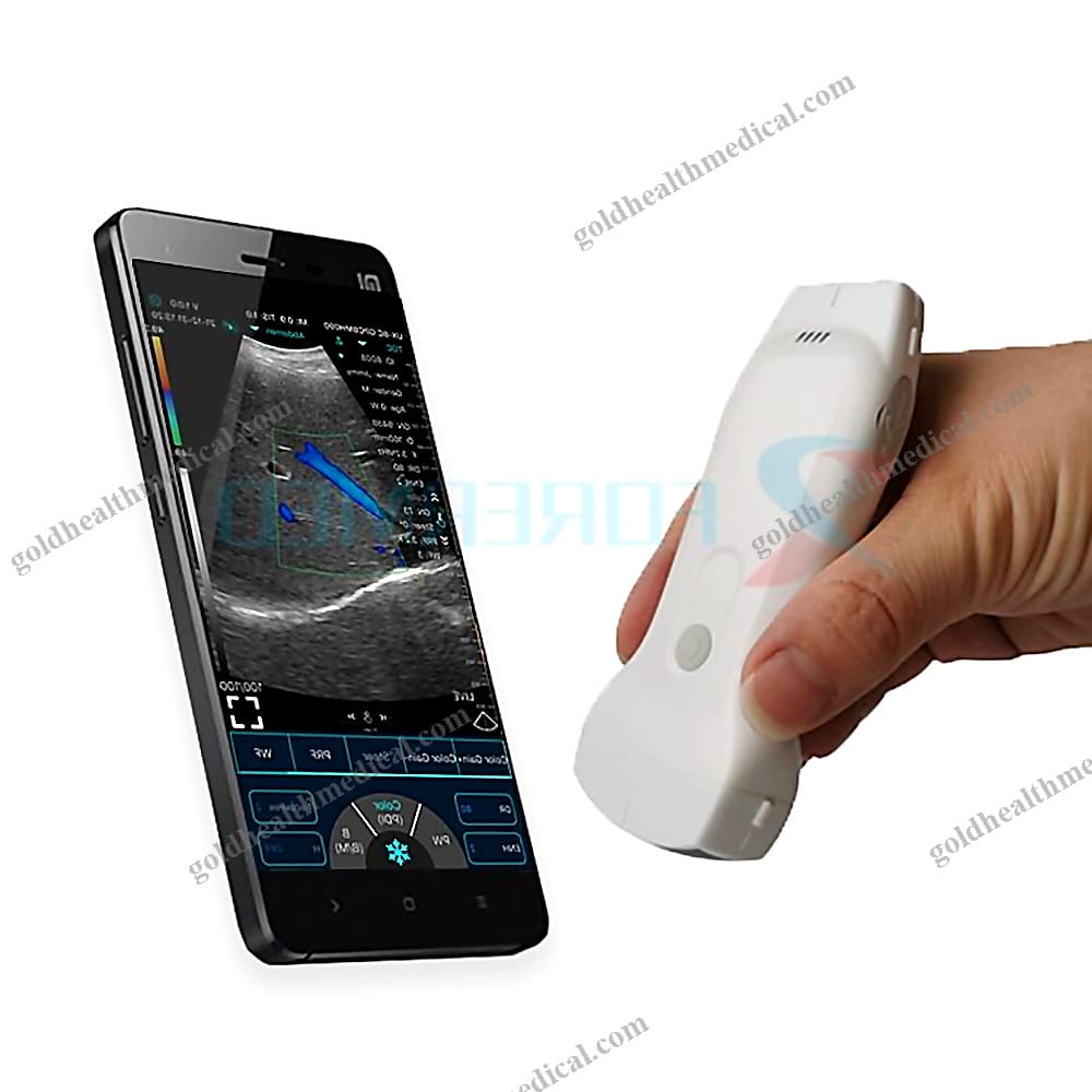 Portable PICC Wireless Ultrasound Probe with 3in1 Linear Conv