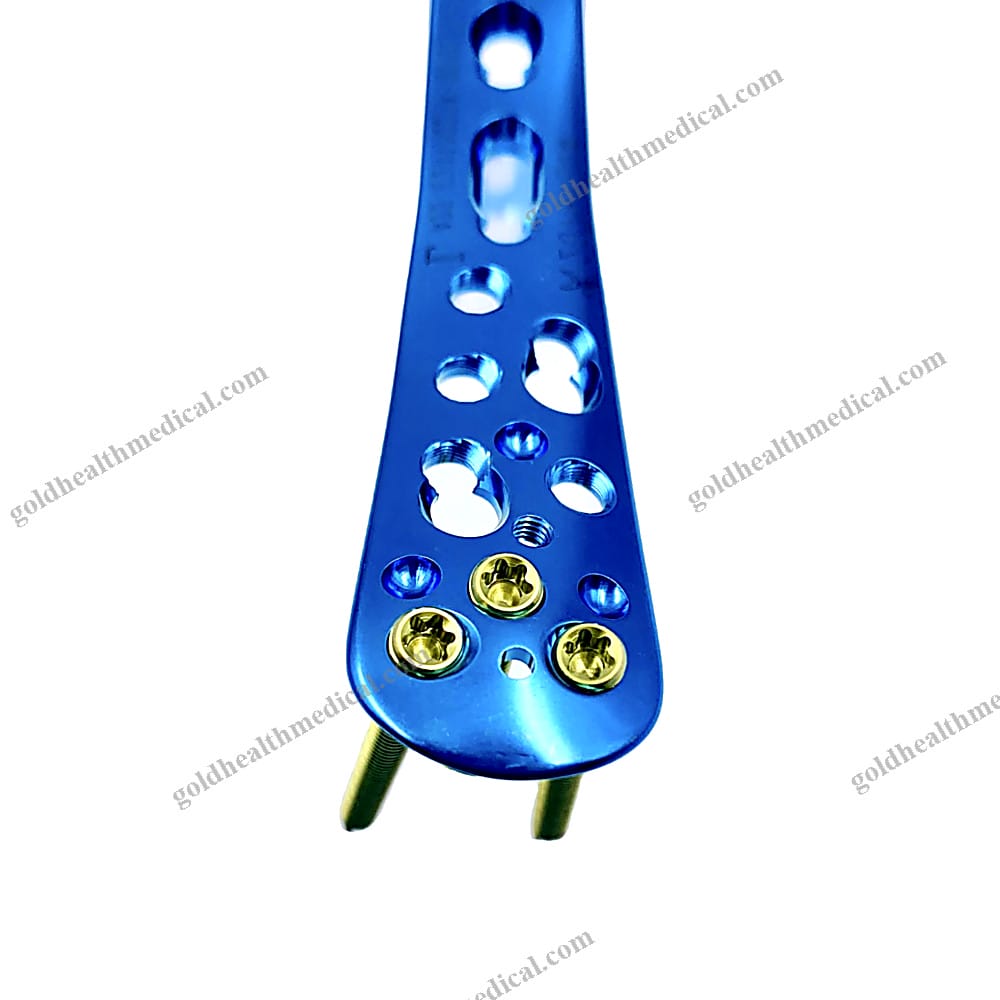 Titanium Cannulated Cancellous Screws for Fracture Fixation
