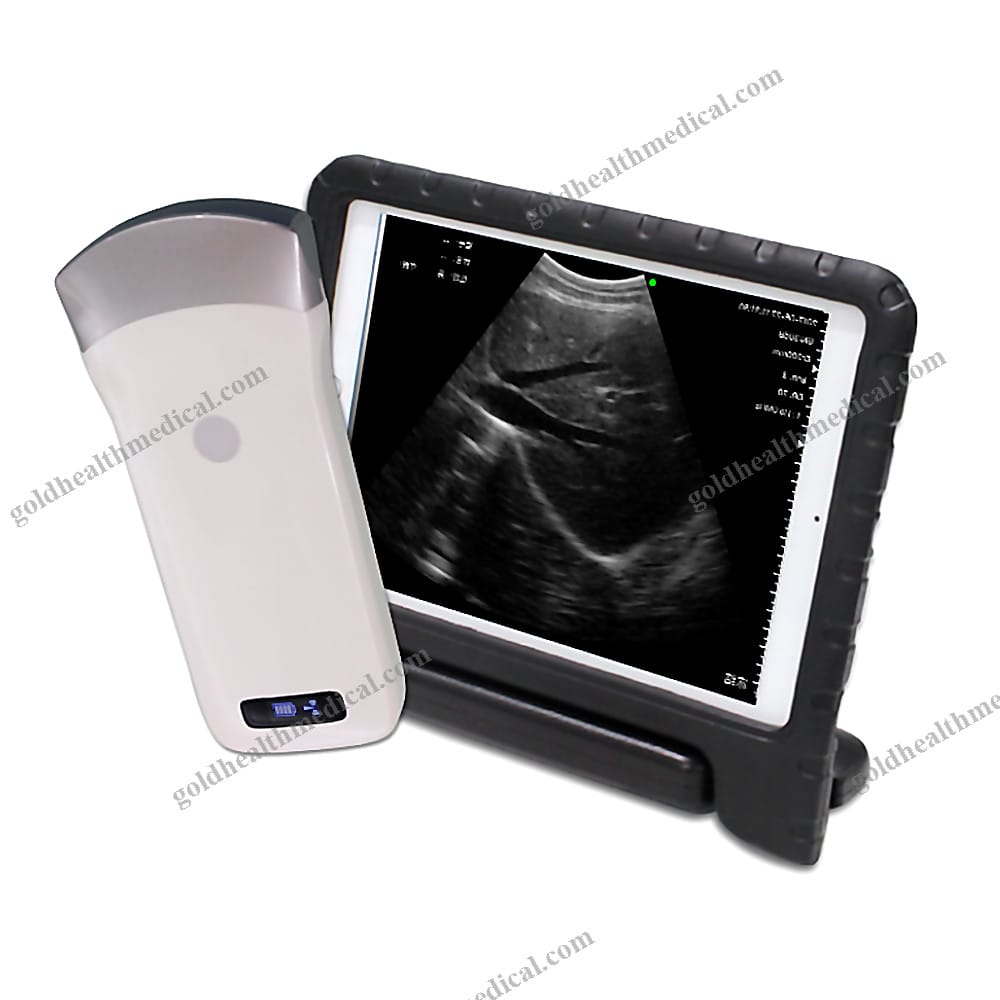 MECAN Mini Wireless Ultrasound Scanner