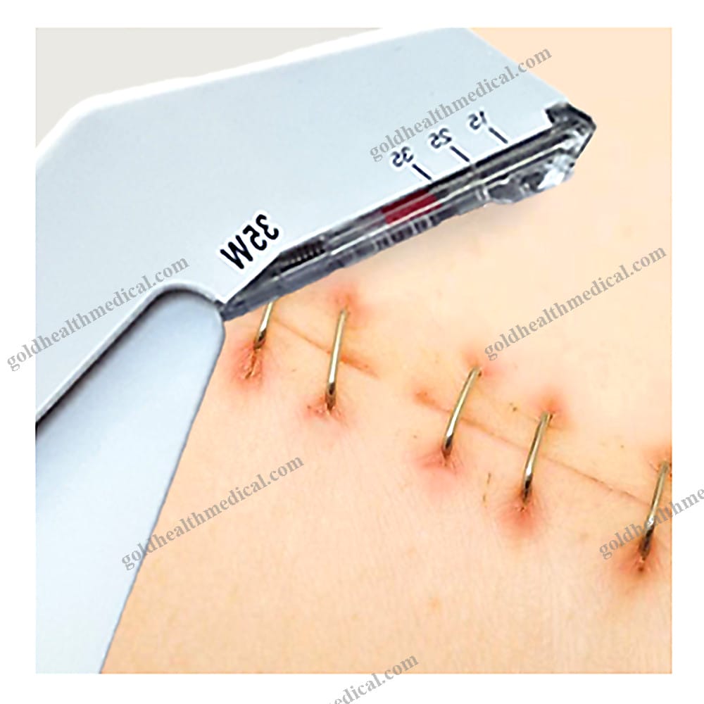 W35 Sterile Disposable Skin Stapler
