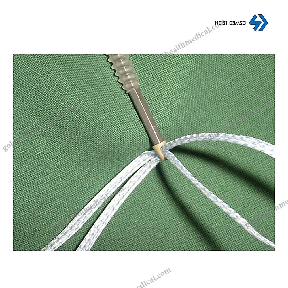 UHMWPE Surgical Suture Tape