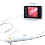 Flexible Disposable Ureteroscope Endoscope