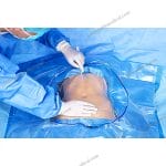 Surgical Drape Collection Pouch Pro