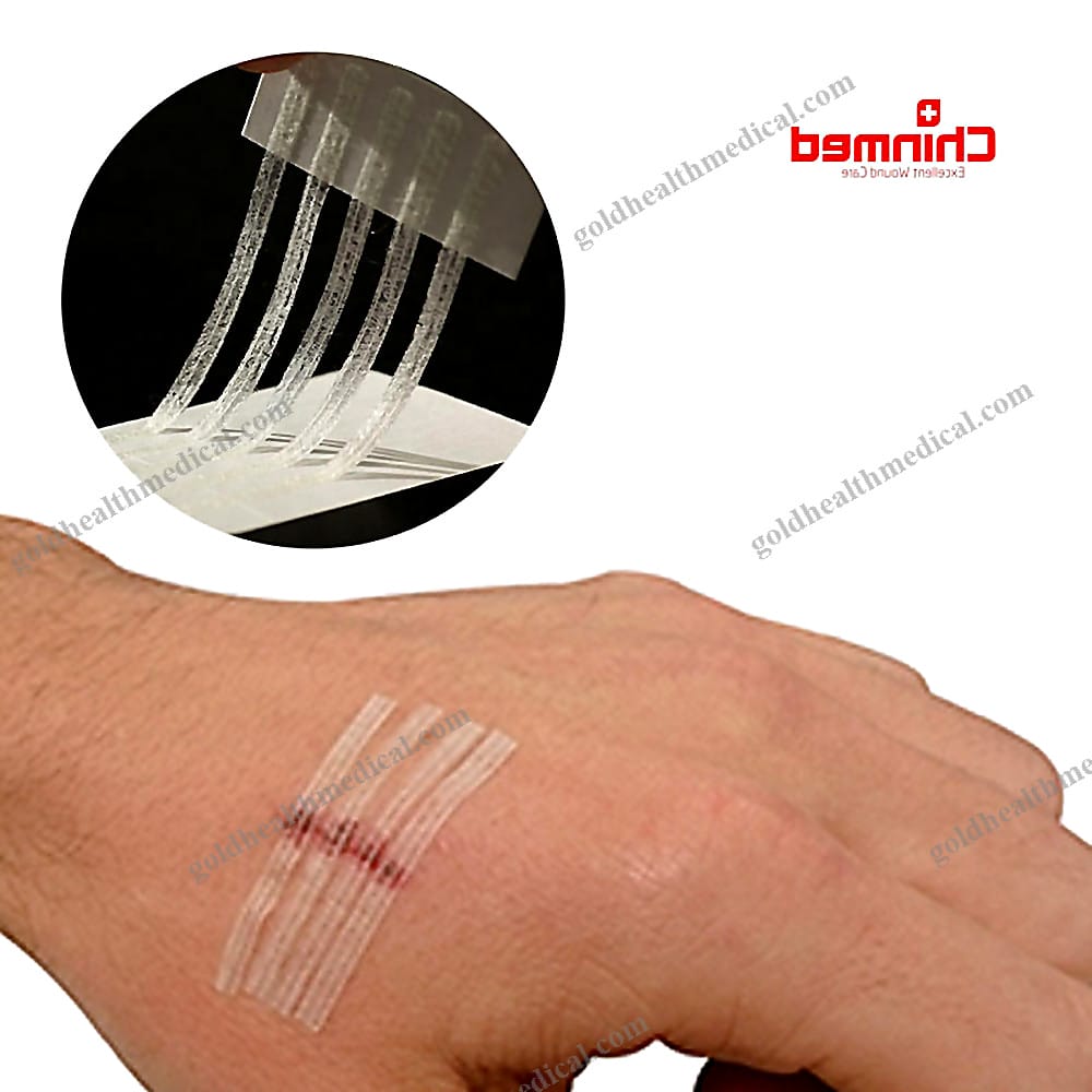 Advanced Waterproof Wound Closure Strips for Emergency Skin Closure Solutions