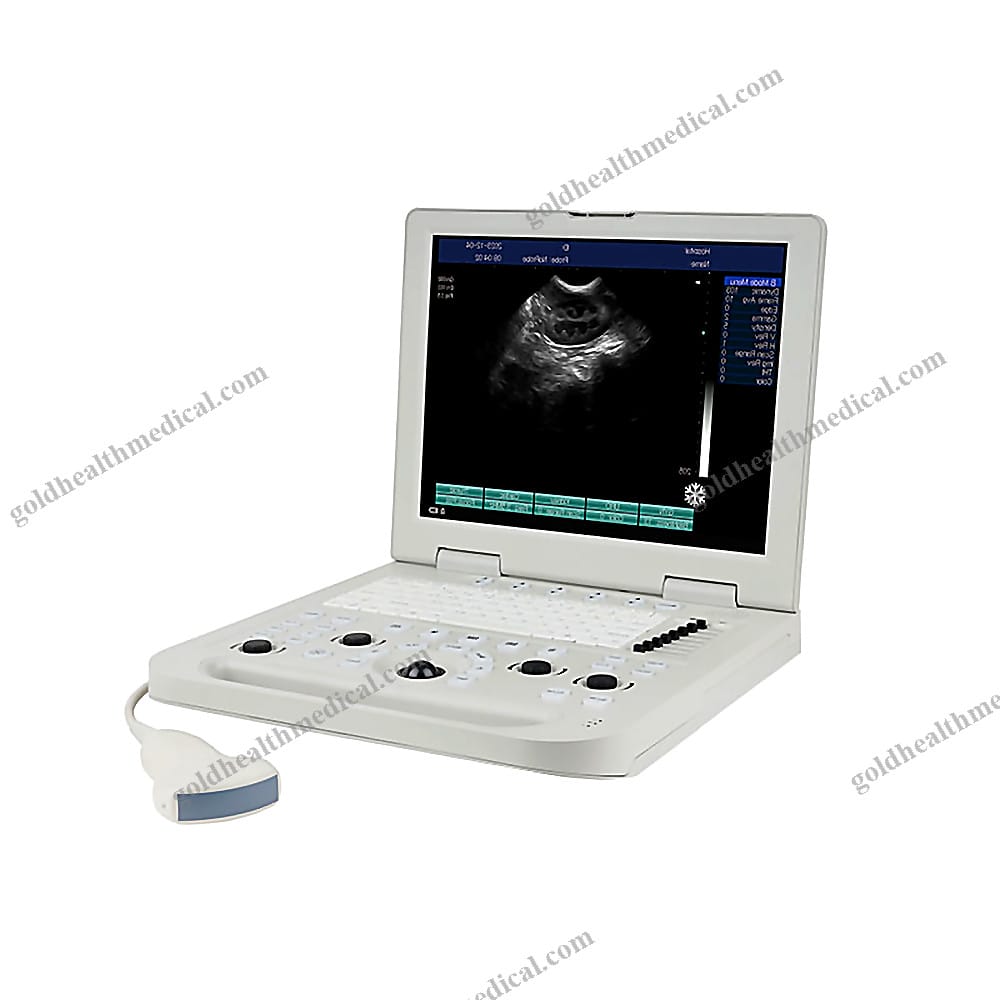 Portable Color Doppler Ultrasound Scanner for Veterinary Diagnostic Imaging