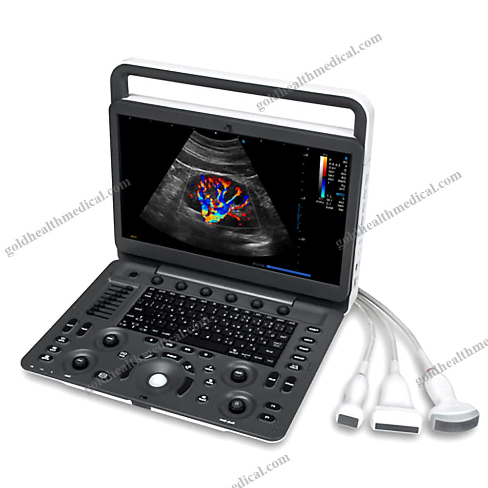 Sonoscape E2V Portable Veterinary Ultrasound Machine