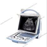 Mindray DP10 Full Digital Portable Ultrasound Machine for Medical Use
