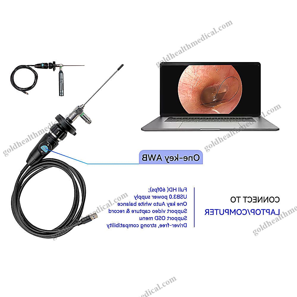 USB30 1080P HD Portable ENT Endos