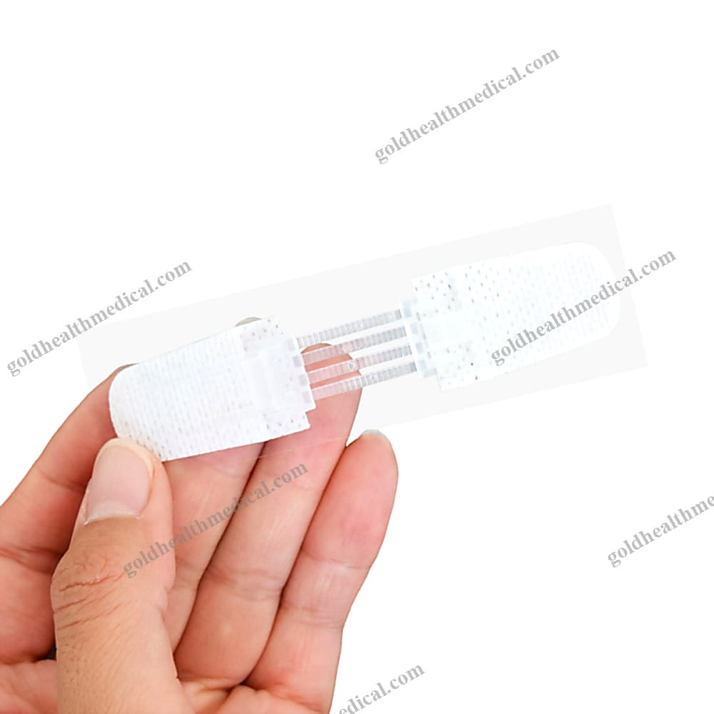 Zip Sutures NonWoven Wound Closure Device
