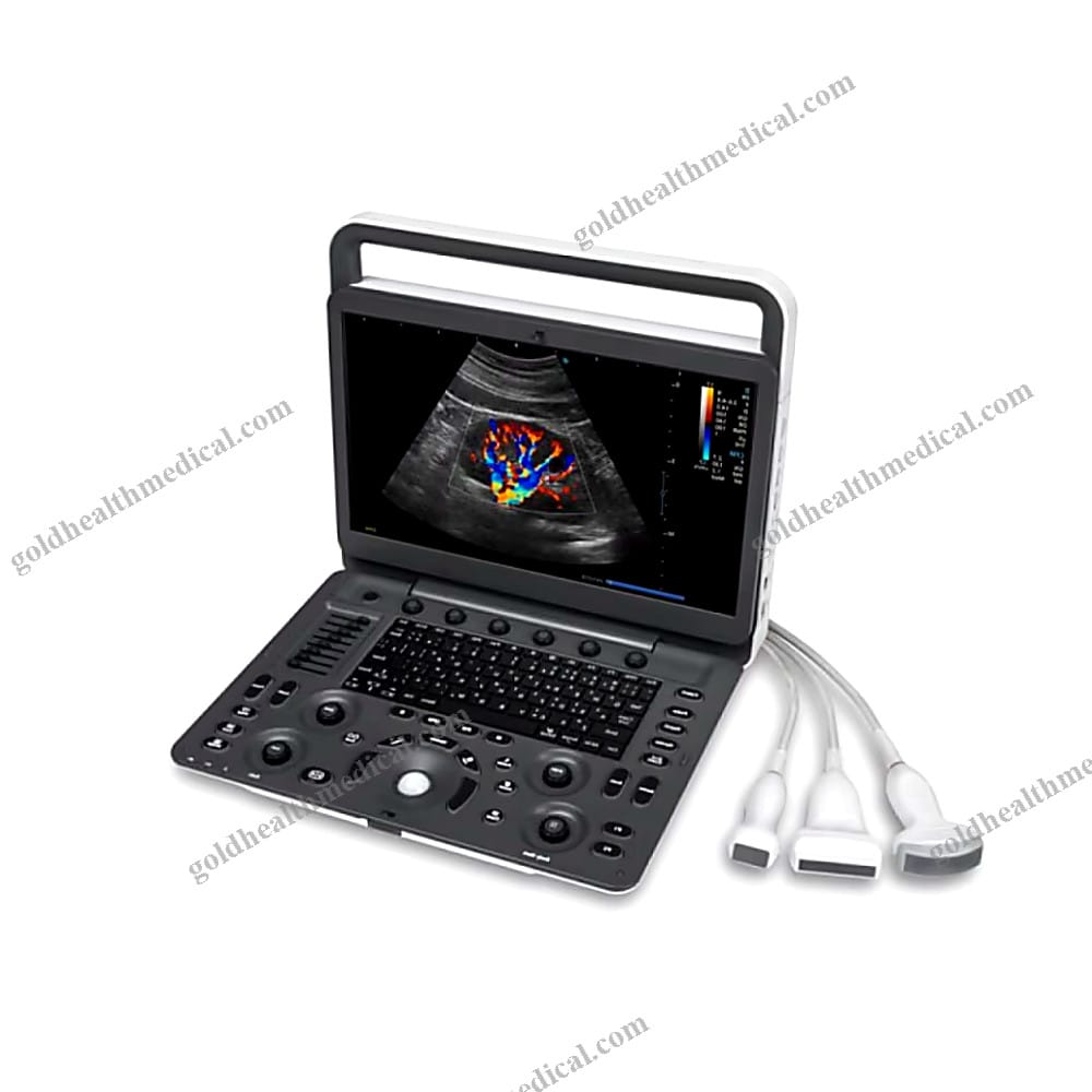 Sonoscape Portable Cardiac Ultrasound Machine for Heart Disease Diagnosis