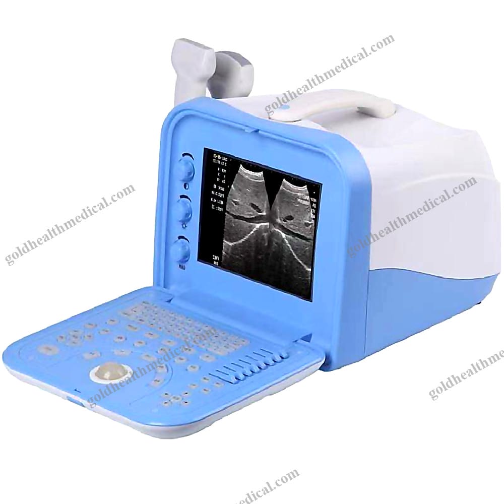 PT6353A Portable Ultrasound Scanner with 10
