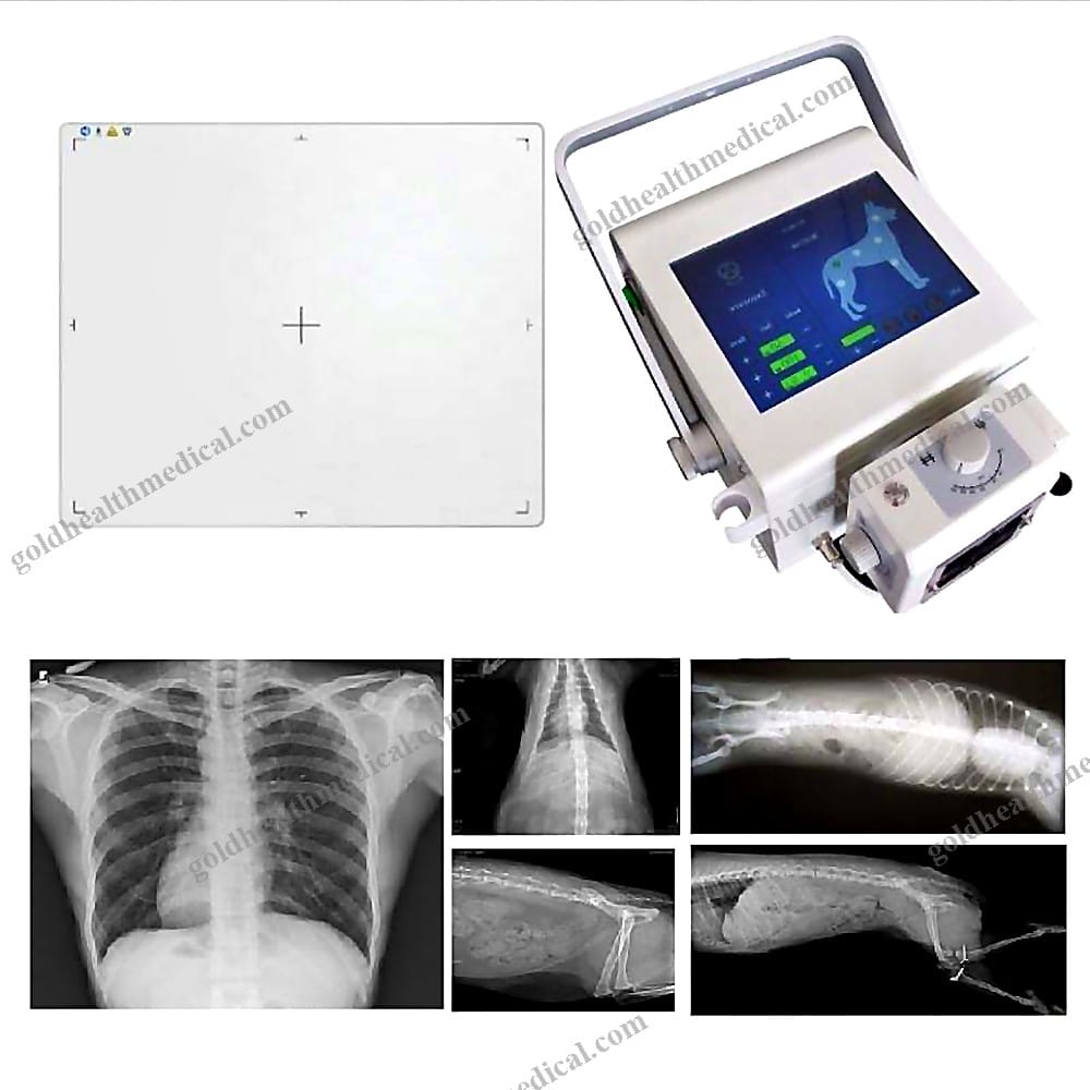 Portable XRay Machine with DR Panel for Radiography Imaging Diagnosis Digit Xray