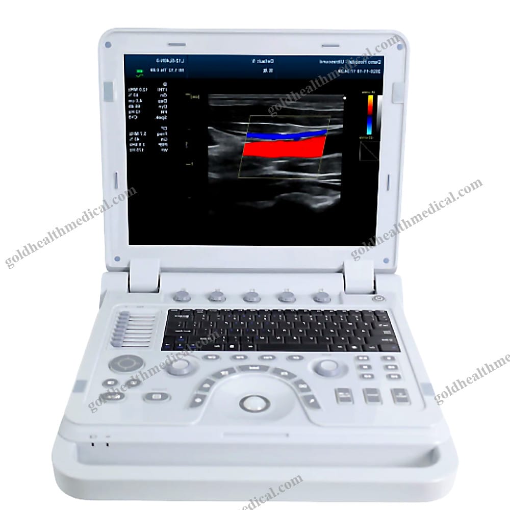 Portable Ultrasound диагностическая система с электропитанием для дом