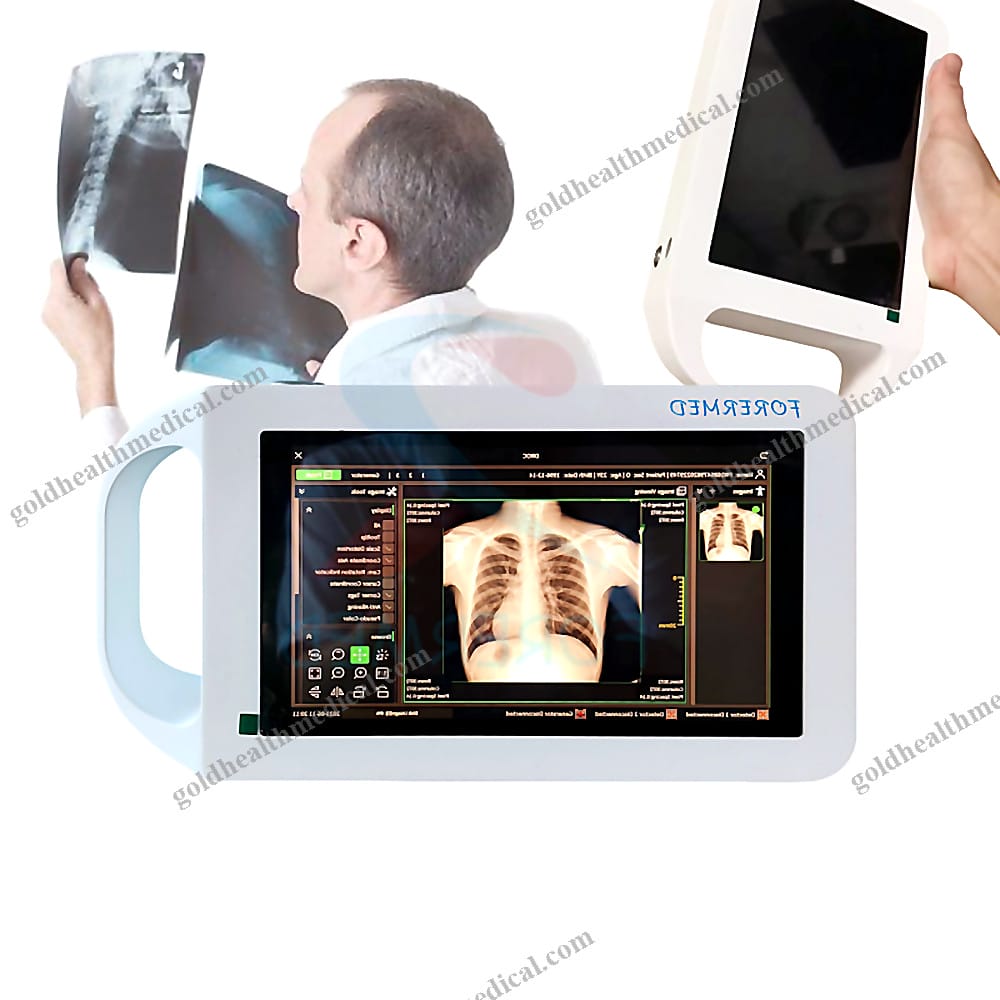 Portable DR Xray Machine with Optional Wireless Detector
