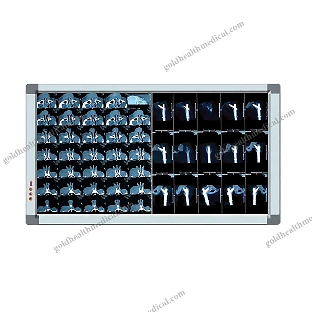 OM MEDICAL LED Xray Double Panel Illuminator Viewer