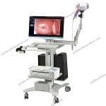 Portable Digital Colposcope for Gynecology
