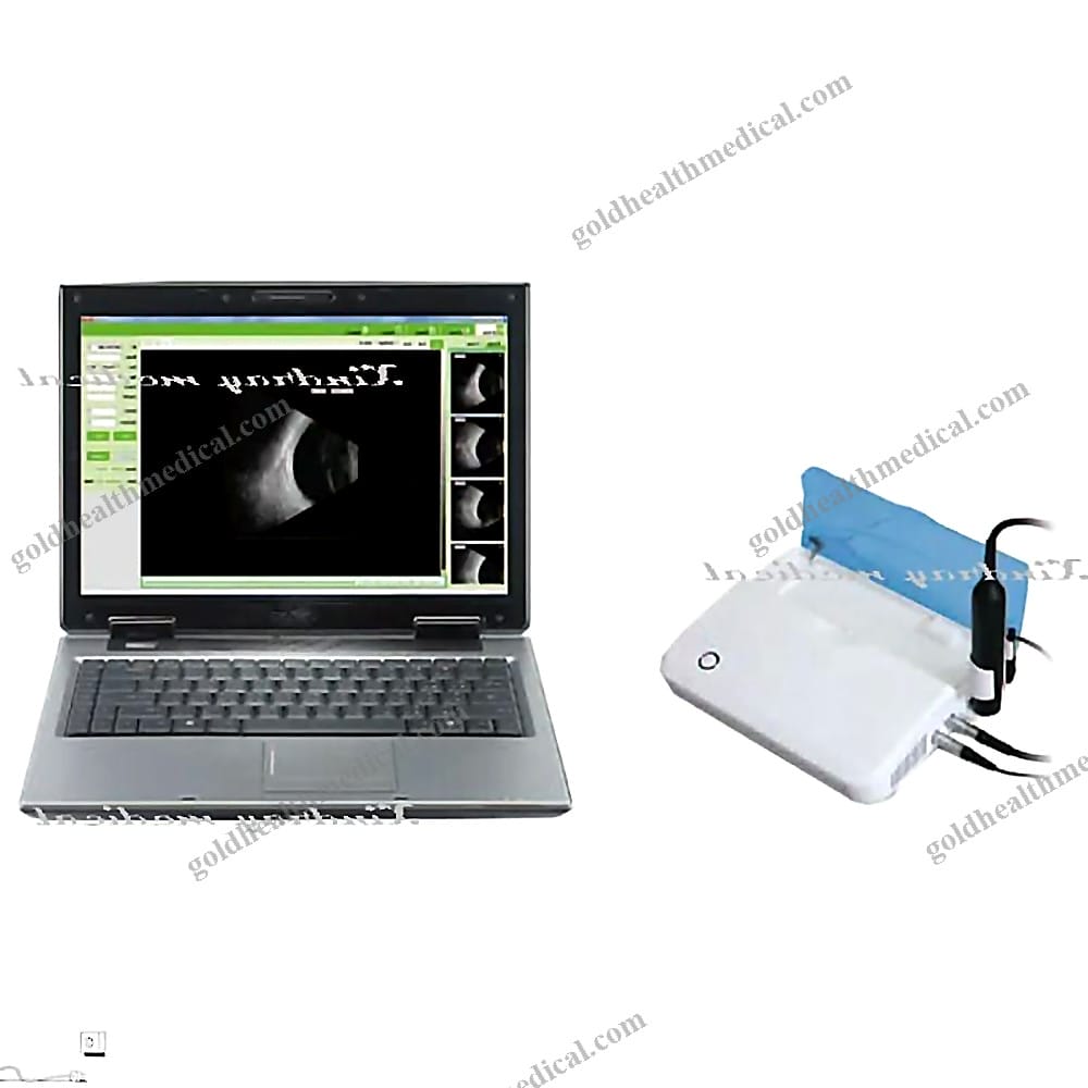SP2000 Ophthalmic Ultrasound Biometer AB Scan