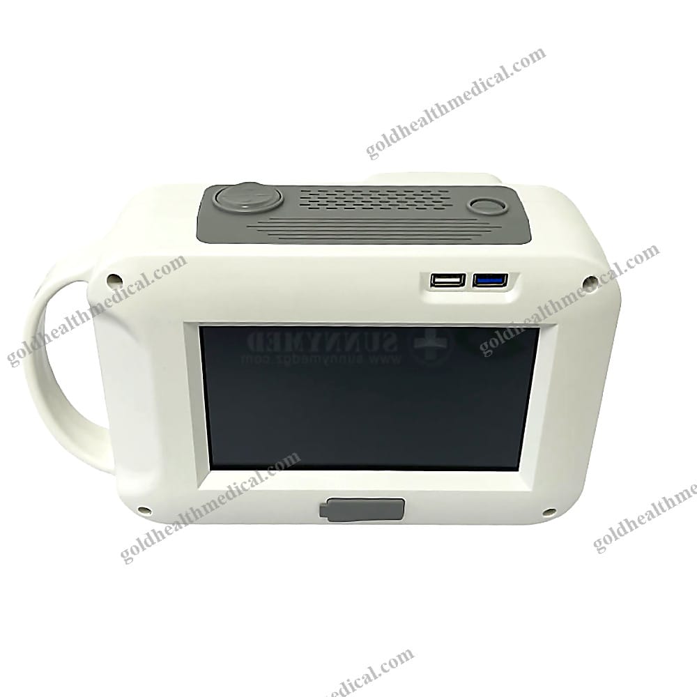 SYD034 Portable Xray System Advanced Affordable Clinical