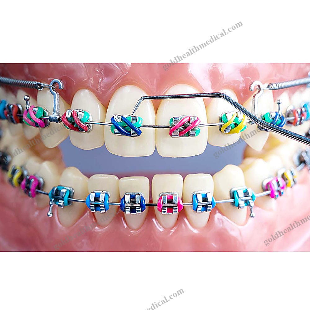 Guber Orthodontic Ligature Tie NonLatex Three Color Dental