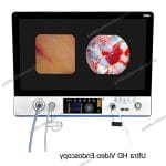 SNUKE X240MC HD Portable Endoscopy Camera for