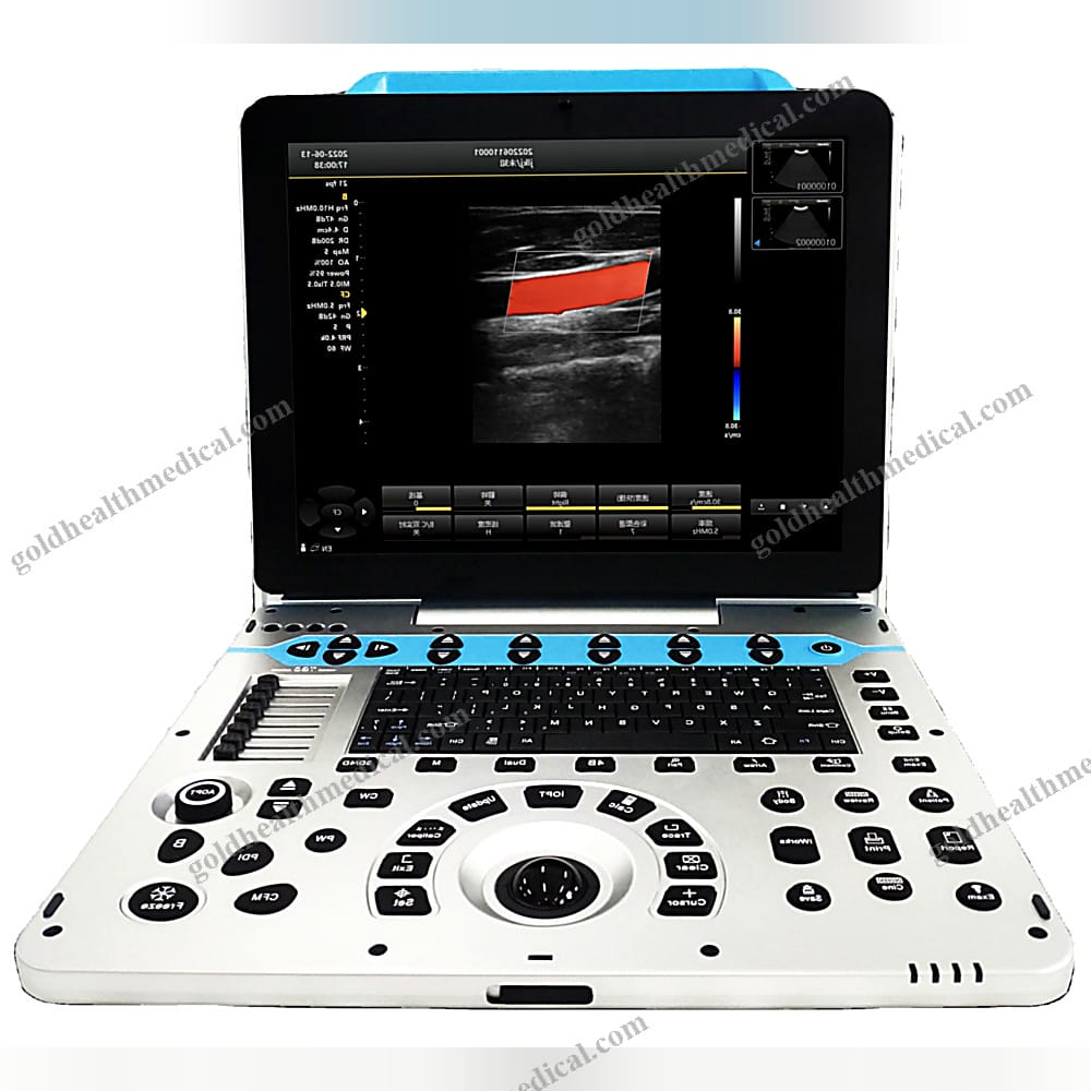Advanced Veterinary Ultrasound System for Abdominal Color Doppler and