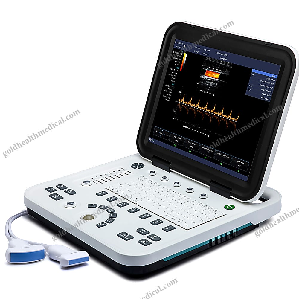 KU1 Portable Digital Color Doppler Ultrasound System