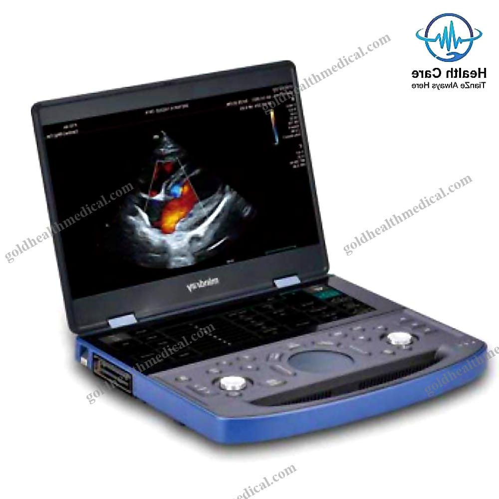 Mindray Vetus E7 Portable Veterinary Ultrasound System