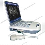Portable Color Doppler Ultrasound System for Hospitals and Clinics