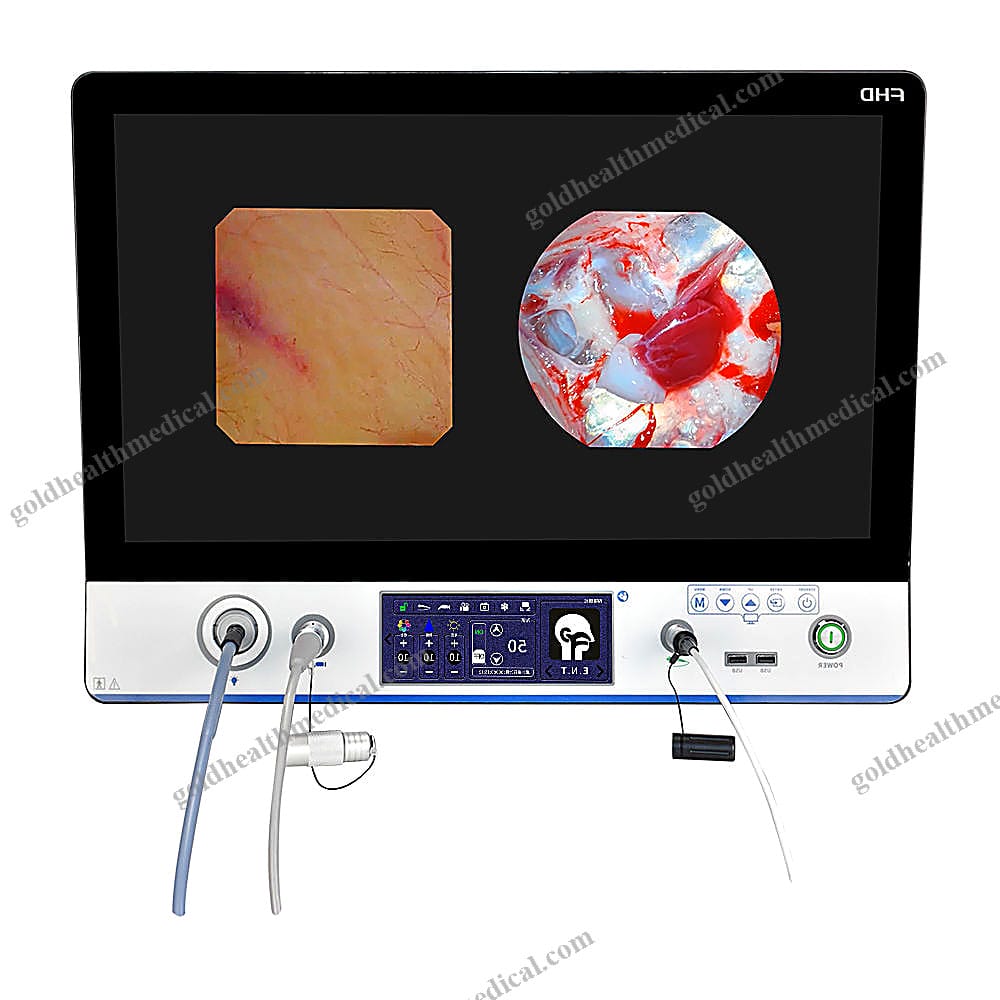 SNUKE X240MC Full HD 1080