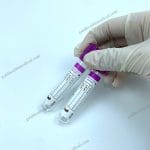 EDTA K2K3 Vacuum Blood Collection Tubes